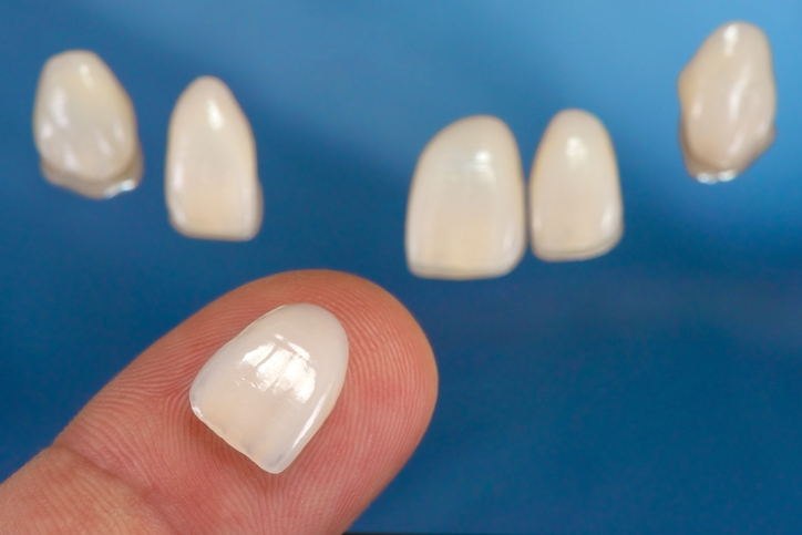 Teeth Veneers in Spokane Valley, Washington with Coulter Family Dentistry Teeth Veneers in Spokane Valley, Washington with Coulter Family Dentistry