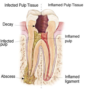 Endodontist patientendo2