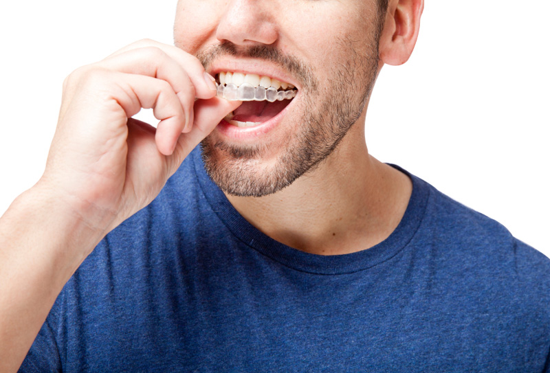 ClearCorrect Clear Braces in Spokane Valley, WA ClearCorrect Clear Braces in Spokane Valley, WA