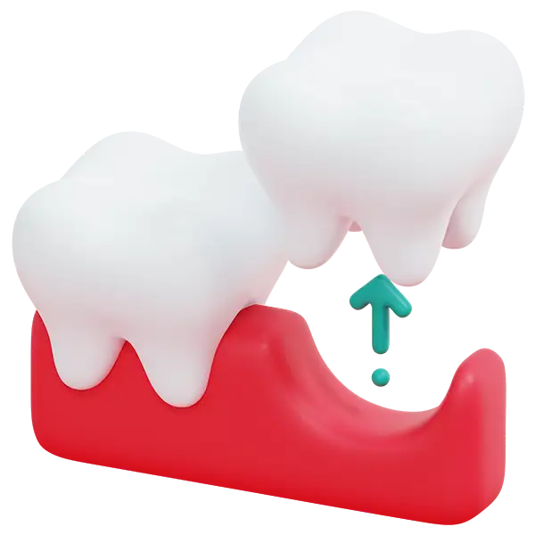 A tooth lifted upward out of the gums, demonstrating the basics of tooth extraction.